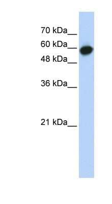 Western Blot: LRRC6 Antibody [NBP1-53157] - Transfected 293T cell lysate, concentration 0.2-1 ug/ml.