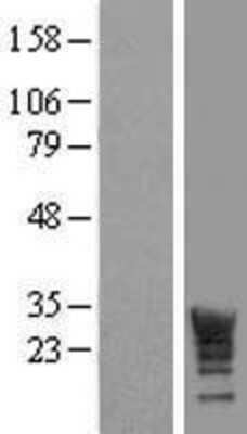 Western Blot LRRC61 Overexpression Lysate