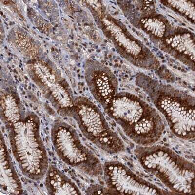 Immunohistochemistry-Paraffin: LRRC63 Antibody [NBP1-90670] - Staining of human stomach, upper shows strong cytoplasmic and nuclear positivity in glandular cells.