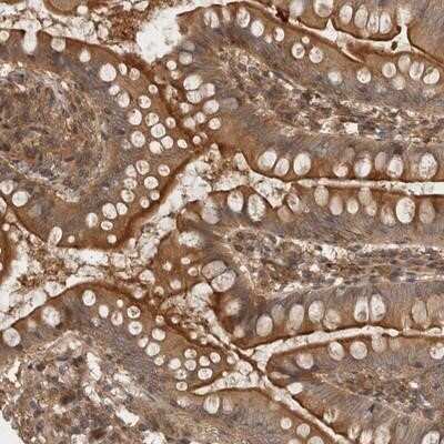 Immunohistochemistry-Paraffin: LRRC67 Antibody [NBP1-84046] - Staining of human small intestine shows distinct cytoplasmic positivity in glandular cells.