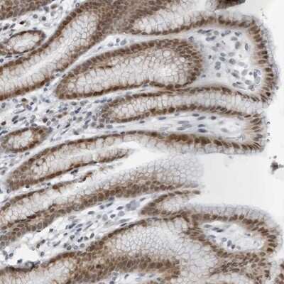 Immunohistochemistry-Paraffin LRRC67 Antibody