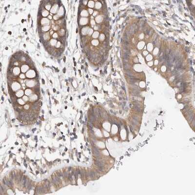 Immunohistochemistry-Paraffin: LRRC67 Antibody [NBP1-84048] - Staining of human colon shows moderate cytoplasmic positivity in glandular cells.