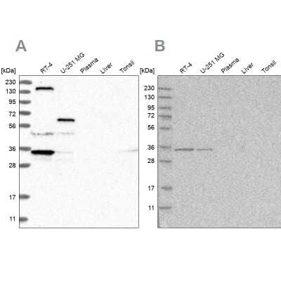 Western Blot LRRC67 Antibody