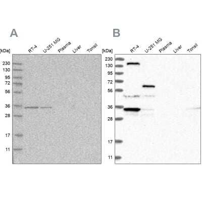 Western Blot: LRRC67 Antibody [NBP1-84048] - Analysis using Anti-PPP1R42 antibody NBP1-84048 (A) shows similar pattern to independent antibody NBP1-84047 (B).