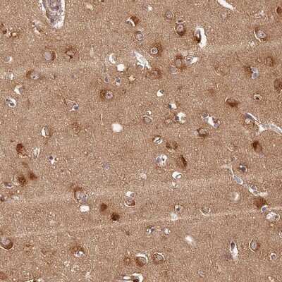 Immunohistochemistry-Paraffin: LRRC68 Antibody [NBP1-90889] - Staining of human cerebral cortex shows strong cytoplasmic positivity in neuronal cells.