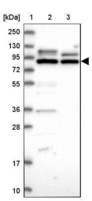 Western Blot: LRRC68 Antibody [NBP1-90889] - Lane 1: Marker [kDa] 250, 130, 95, 72, 55, 36, 28, 17, 10Lane 2: Human cell line RT-4Lane 3: Human cell line U-251MG sp