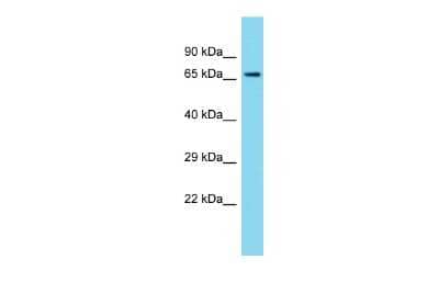 Western Blot: LRRC68 Antibody [NBP2-83161] - Host: Rabbit. Target Name: PPP1R37. Sample Type: Fetal Heart lysates. Antibody Dilution: 1.0ug/ml