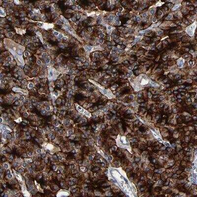 Immunohistochemistry: LRRC70 Antibody [NBP1-93554] - Staining of human parathyroid gland shows strong cytoplasmic and membranous positivity in glandular cells.