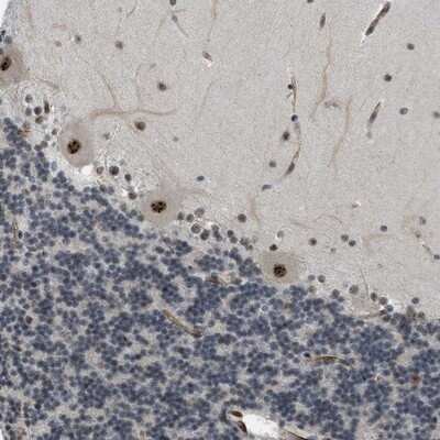 Immunohistochemistry-Paraffin: LRRC8B Antibody [NBP1-81532] - Staining of human cerebellum shows strong nuclear positivity in Purkinje cells.