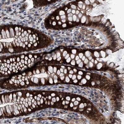 Immunohistochemistry-Paraffin: LRRC8C Antibody [NBP1-90871] - Staining of human colon shows strong nuclear membrane and cytoplasmic positivity in glandular cells.