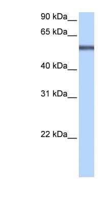 Western Blot: LRRC8E Antibody [NBP1-60062] - HepG2 cell lysate, concentration 0.2-1 ug/ml.