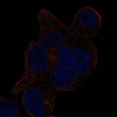Immunocytochemistry/Immunofluorescence: LRRCC1 Antibody [NBP3-17600] - Staining of human cell line HEL shows localization to centrosome.