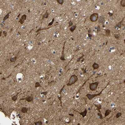 Immunohistochemistry-Paraffin: LRRCC1 Antibody [NBP1-93577] - Staining of human cerebral cortex shows strong cytoplasmic positivity in neuronal cells.