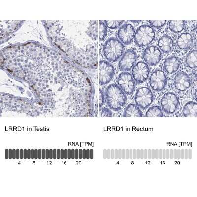 Immunocytochemistry/Immunofluorescence: LRRD1 Antibody [NBP3-16965] - Analysis in human testis and rectum tissues using Anti-LRRD1 antibody. Corresponding LRRD1 RNA-seq data are presented for the same tissues.
