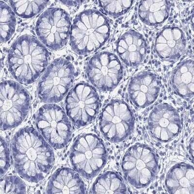 Immunohistochemistry-Paraffin: LRRD1 Antibody [NBP3-16965] - Staining of human rectum shows low expression as expected.