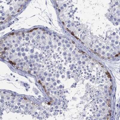 Immunohistochemistry-Paraffin: LRRD1 Antibody [NBP3-16965] - Staining of human testis shows high expression.
