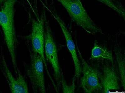 Immunocytochemistry/ Immunofluorescence LRRFIP1 Antibody