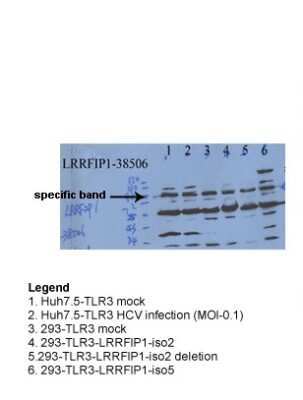 Western Blot: LRRFIP1 Antibody [NBP2-87745] - Sample Type: Hepatitis C Virus & 293 TransfectionsPrimary Dilution: 1ug/mL