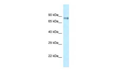 Western Blot: LRRFIP1 Antibody [NBP2-87746] - WB Suggested Anti-Lrrfip1 Antibody. Titration: 1.0 ug/ml. Positive Control: Mouse Small Intestine