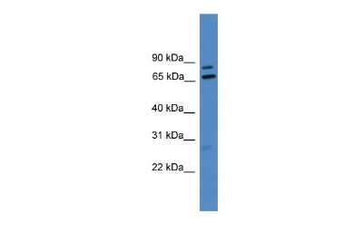 Western Blot: LRRFIP1 Antibody [NBP2-87747] - WB Suggested Anti-LRRFIP1 Antibody Titration: 0.2-1 ug/ml. ELISA Titer: 1:312500. Positive Control: U937 cell lysate