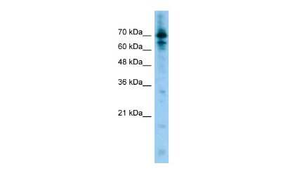 Western Blot: LRRFIP1 Antibody [NBP2-87747] - Host: Rabbit. Target Name: LRRFIP1. Sample Type: Jurkat Whole Cell lysates. Antibody Dilution: 1.0ug/mlLRRFIP1 is strongly supported by BioGPS gene expression data to be expressed in Human Jurkat cells