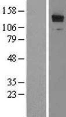 Western Blot: LRRFIP1 Overexpression Lysate (Adult Normal) [NBL1-12709] Left-Empty vector transfected control cell lysate (HEK293 cell lysate); Right -Over-expression Lysate for LRRFIP1.