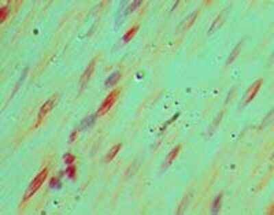 Immunohistochemistry-Paraffin LRRFIP2 Antibody