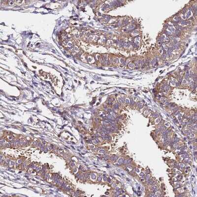 Immunohistochemistry-Paraffin: LRRIQ1 Antibody [NBP1-92080] - Staining of human fallopian tube shows moderate cytoplasmic positivity in glandular cells.