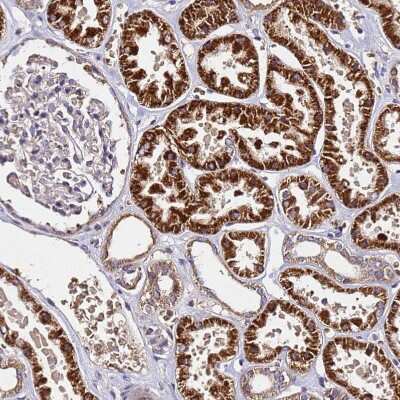 Immunohistochemistry-Paraffin: LRRIQ1 Antibody [NBP1-92080] - Staining of human kidney shows strong cytoplasmic positivity in cells in tubules.