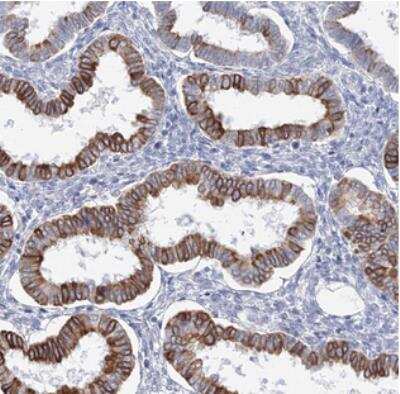 Immunohistochemistry LRRIQ4 Antibody - BSA Free