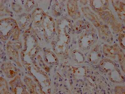 Immunohistochemistry: LRRK2 Antibody (4E9) [NBP3-15156] - IHC image of LRRK2 antibody diluted at 1:100 and staining in paraffin-embedded human kidney tissue. After dewaxing and hydration, antigen retrieval was mediated by high pressure in a citrate buffer (pH 6.0). Section was blocked with 10% normal goat serum 30 minutes at RT. Then primary antibody (1% BSA) was incubated at 4C overnight. The primary is detected by a Goat anti-rabbit IgG polymer labeled by HRP and visualized using 0.05% DAB.