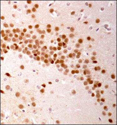 Immunohistochemistry: LRRK2 Antibody [NBP1-78299] - Analysis of LRRK2 in mouse brain using DAB with hematoxylin counterstain.