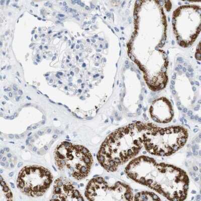 Immunohistochemistry-Paraffin: LRRK2 Antibody [NBP2-48524] - Staining of human kidney shows strong granular cytoplasmic positivity in cells in tubules.