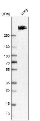 Western Blot: LRRK2 Antibody [NBP2-48524] - Analysis in human lung tissue.