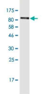 Western Blot: LRRN1/NLRR-1 Antibody (4G8) [H00057633-M09-100ug] - Detection against Immunogen (106.7 KDa).