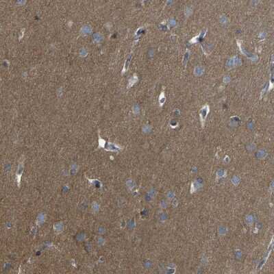 Immunohistochemistry-Paraffin: LRRN1/NLRR-1 Antibody [NBP1-83896] - Staining of human cerebral cortex shows high expression.