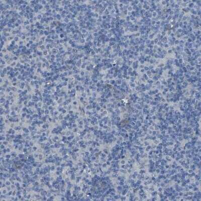 Immunohistochemistry-Paraffin: LRRN1/NLRR-1 Antibody [NBP1-83896] - Staining of human lymph node shows low expression as expected.