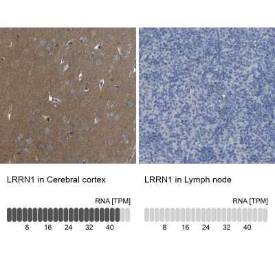 Immunohistochemistry-Paraffin: LRRN1/NLRR-1 Antibody [NBP1-83896] - Staining in human cerebral cortex and lymph node tissues using anti-LRRN1 antibody. Corresponding LRRN1 RNA-seq data are presented for the same tissues.