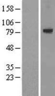 Western Blot: LRRN1 Overexpression Lysate (Adult Normal) [NBL1-12711] Left-Empty vector transfected control cell lysate (HEK293 cell lysate); Right -Over-expression Lysate for LRRN1.