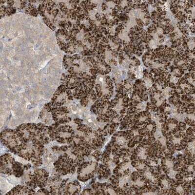 Immunohistochemistry-Paraffin LRRN2 Antibody