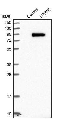 Western Blot LRRN2 Antibody