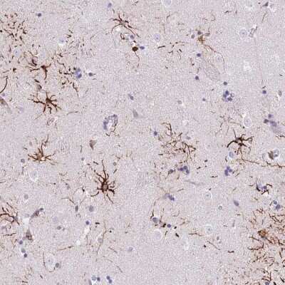 Immunohistochemistry-Paraffin: LRRN3/NLRR-3 Antibody [NBP2-30614] - Staining of human lateral ventricle shows strong positivity in astrocytes.