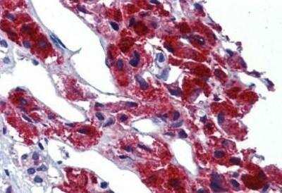 Immunohistochemistry-Paraffin: LRRN4 Antibody [NBP1-50177] - Analysis of anti-LRRN4 / C20orf75 antibody with human adrenal at concentration 10 ug/ml.