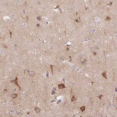 Immunohistochemistry: LRRTM1 Antibody [NBP2-37998] - Staining of human cerebral cortex shows strong cytoplasmic  positivity in neuronal cells.