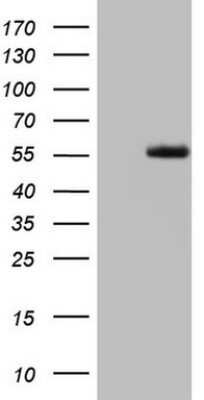 Western Blot: LRRTM1 Antibody (OTI5H9) - Azide and BSA Free [NBP2-72543] - Analysis of HEK293T cells were transfected with the pCMV6-ENTRY control (Left lane) or pCMV6-ENTRY LRRTM1.