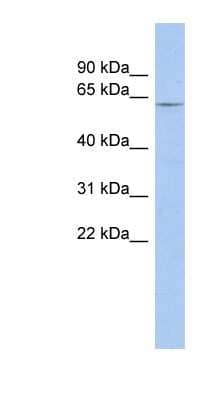 Western Blot: LRRTM1 Antibody [NBP1-62303] - Human Muscle lysate, concentration 0.2-1 ug/ml.