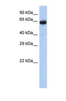 Western Blot: LRRTM1 Antibody [NBP1-69330] - This Anti-LRRTM1 antibody was used in Western Blot of Placenta tissue lysate at a concentration of 1ug/ml.