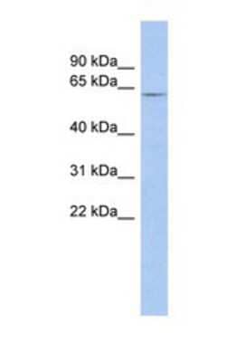 Western Blot: LRRTM1 Antibody [NBP1-69331] - This Anti-LRRTM1 antibody was used in Western Blot of Fetal Muscle tissue lysate at a concentration of 1ug/ml.