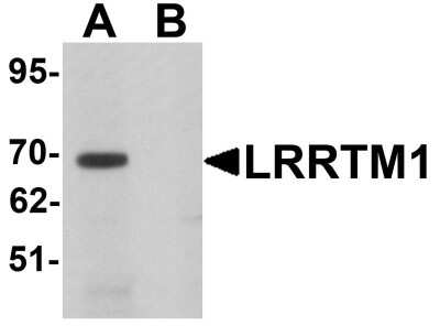 Western Blot LRRTM1 Antibody - BSA Free