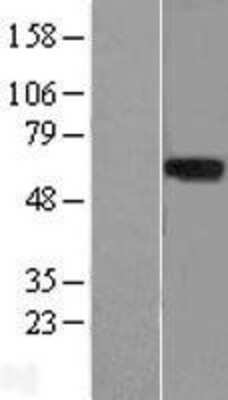 Western Blot: LRRTM1 Overexpression Lysate (Adult Normal) [NBL1-12714] Left-Empty vector transfected control cell lysate (HEK293 cell lysate); Right -Over-expression Lysate for LRRTM1.